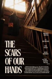 The Scars of Our Hands