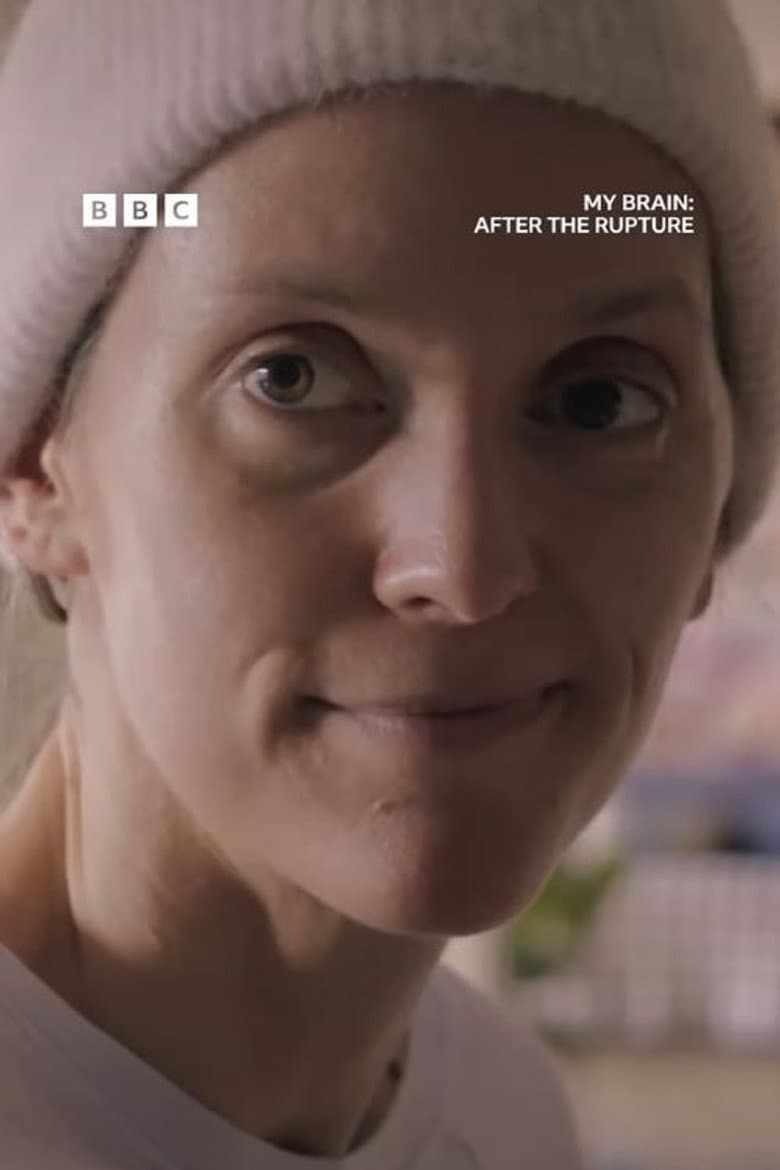 My Brain: After the Rupture poster