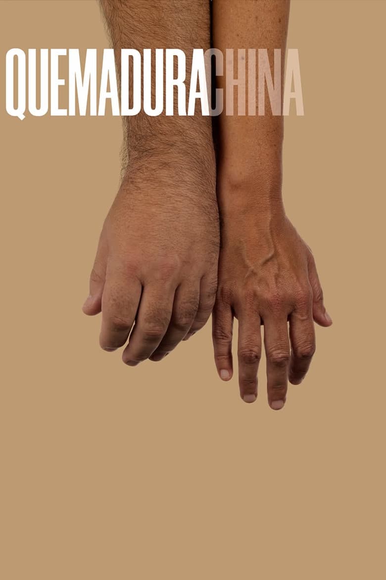 Quemadura china poster